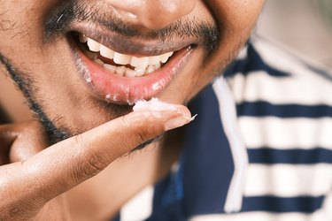 Close up of young man applying petroleum jelly on lip